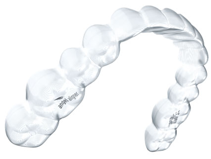 エンジェルアライナーとは