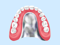 コバルトクロム床義歯